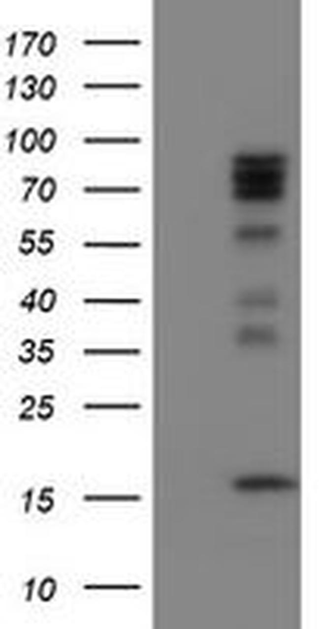 CNOT4 Antibody in Western Blot (WB)