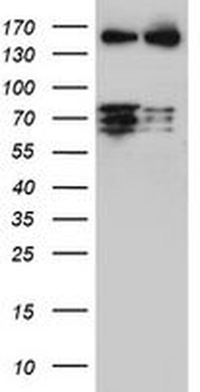 CNOT4 Antibody in Western Blot (WB)