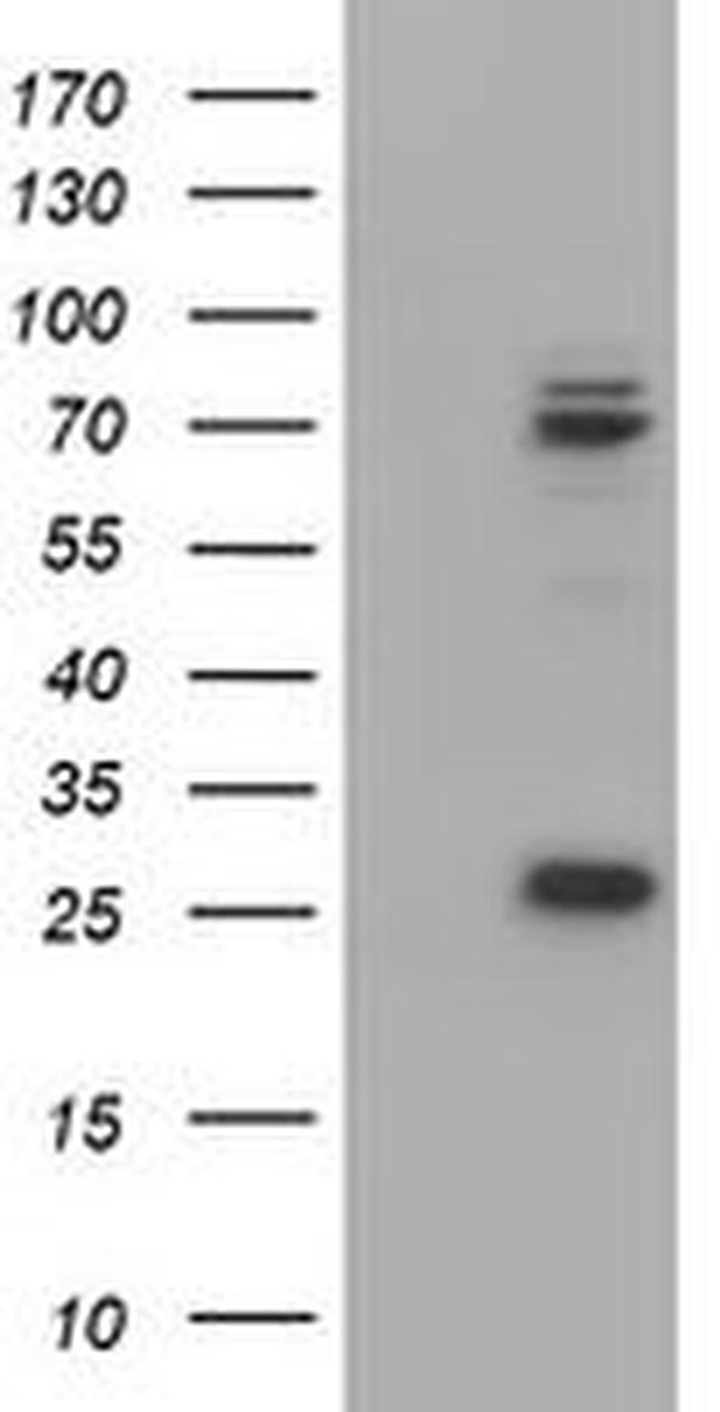 CNOT4 Antibody in Western Blot (WB)