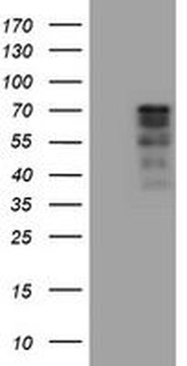 CNOT4 Antibody in Western Blot (WB)