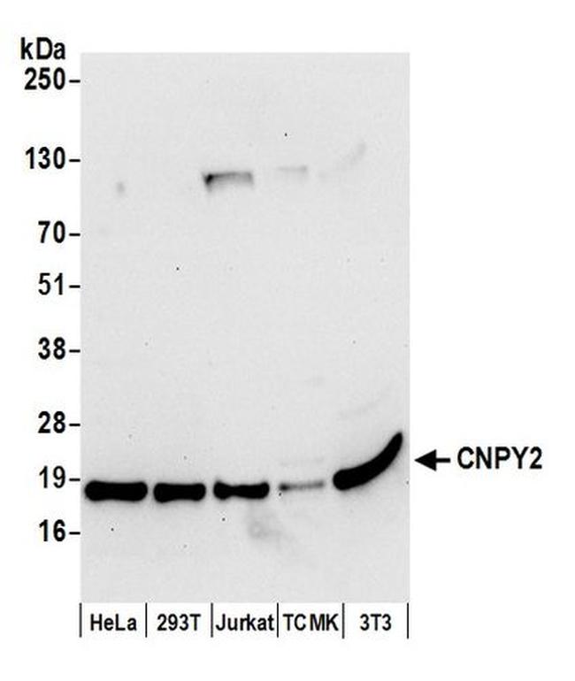 CNPY2 Antibody in Western Blot (WB)