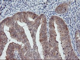 COASY Antibody in Immunohistochemistry (Paraffin) (IHC (P))