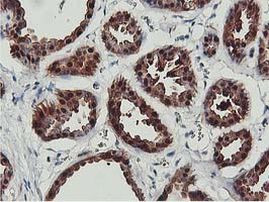 COASY Antibody in Immunohistochemistry (Paraffin) (IHC (P))