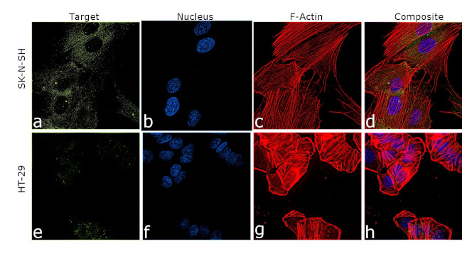 Collagen I Antibody in Immunocytochemistry (ICC/IF)