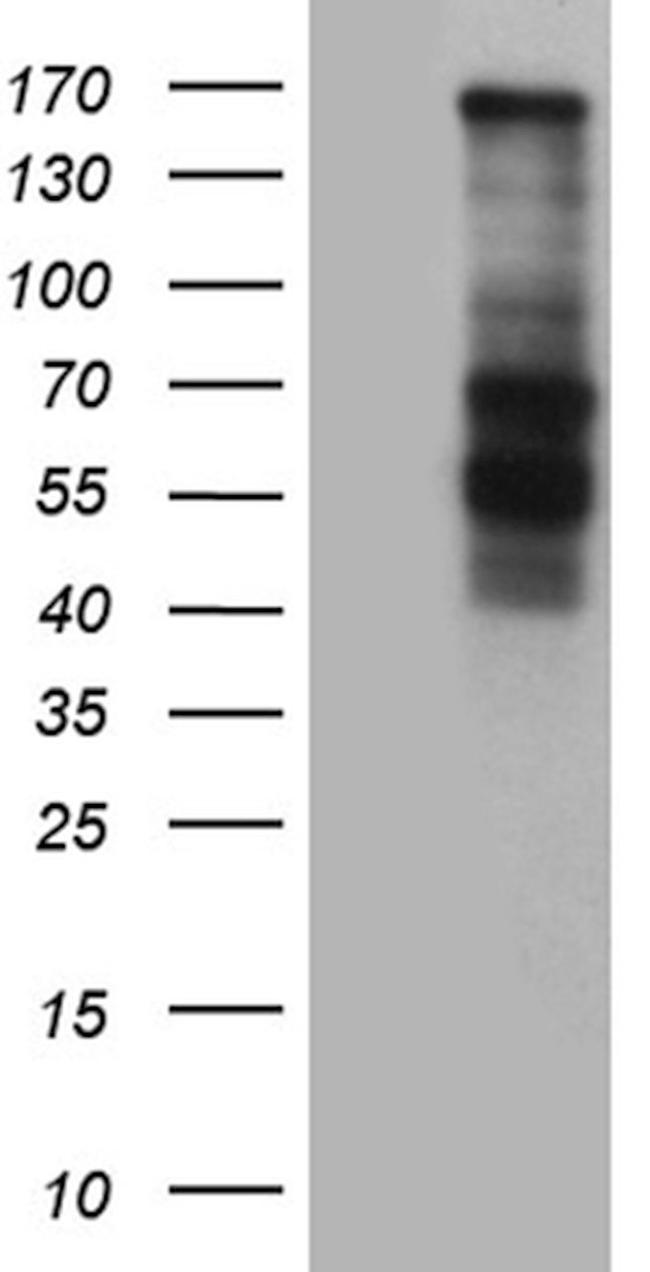 COL3A1 Antibody in Western Blot (WB)