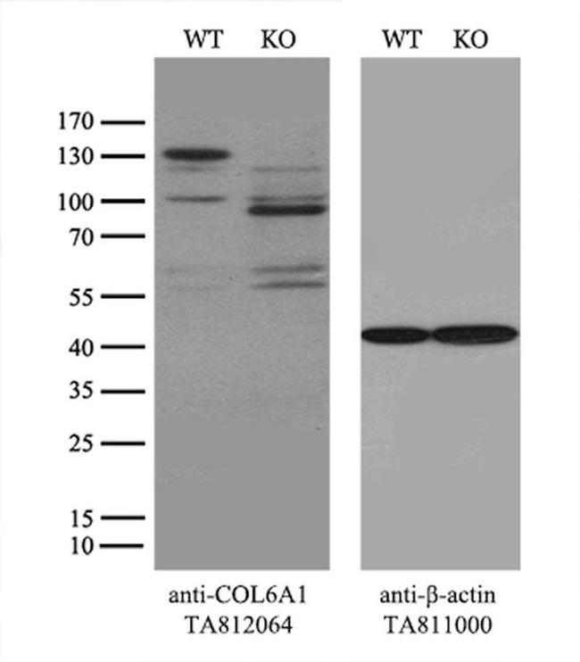 COL6A1 Antibody in Western Blot (WB)