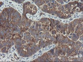 COMMD1 Antibody in Immunohistochemistry (Paraffin) (IHC (P))