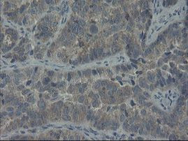 COMMD1 Antibody in Immunohistochemistry (Paraffin) (IHC (P))