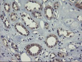 COMMD1 Antibody in Immunohistochemistry (Paraffin) (IHC (P))