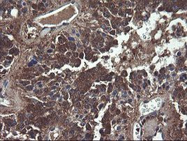 COMMD1 Antibody in Immunohistochemistry (Paraffin) (IHC (P))