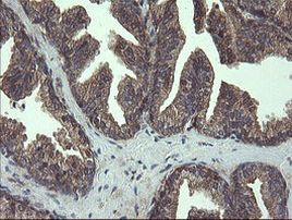 COMMD1 Antibody in Immunohistochemistry (Paraffin) (IHC (P))