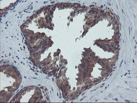 COMMD1 Antibody in Immunohistochemistry (Paraffin) (IHC (P))