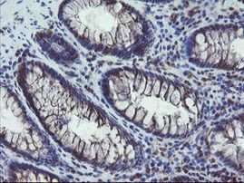 COMMD1 Antibody in Immunohistochemistry (Paraffin) (IHC (P))