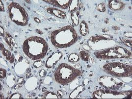 COMMD1 Antibody in Immunohistochemistry (Paraffin) (IHC (P))