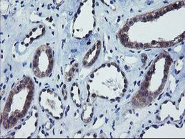 COMMD1 Antibody in Immunohistochemistry (Paraffin) (IHC (P))