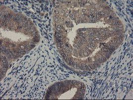 COMMD1 Antibody in Immunohistochemistry (Paraffin) (IHC (P))