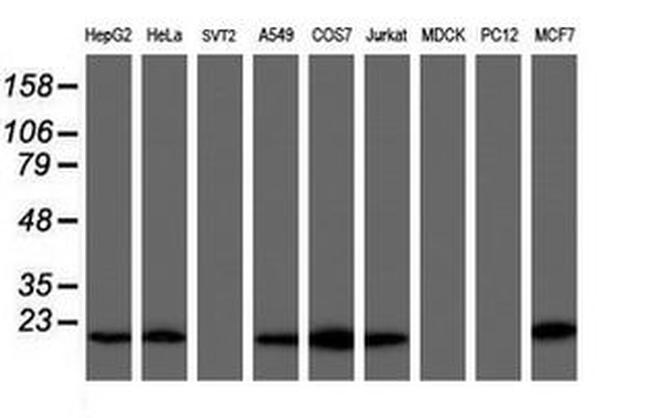 COMMD1 Antibody in Western Blot (WB)