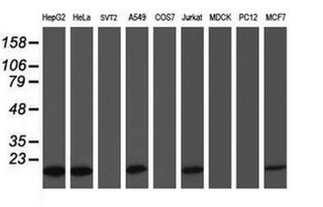 COMMD1 Antibody in Western Blot (WB)