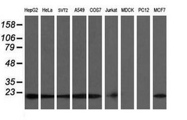 COMMD1 Antibody in Western Blot (WB)