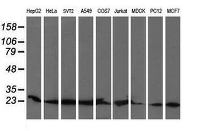 COMMD1 Antibody in Western Blot (WB)