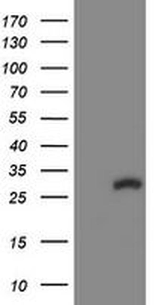 COMMD1 Antibody in Western Blot (WB)