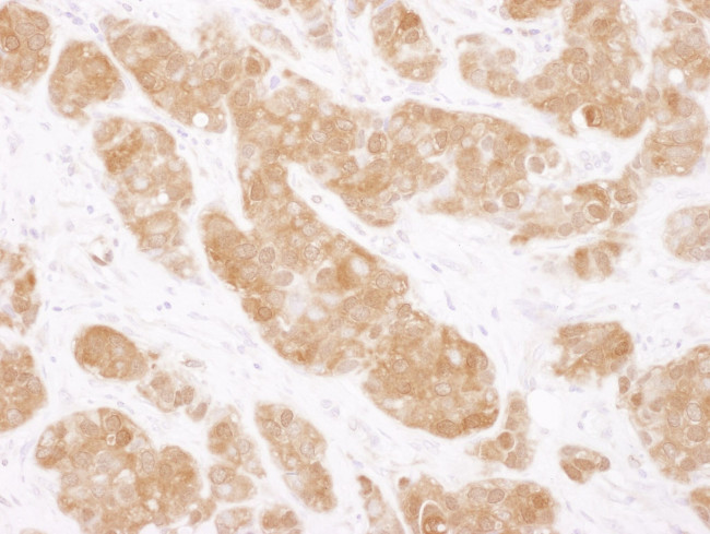 COMT Antibody in Immunohistochemistry (IHC)