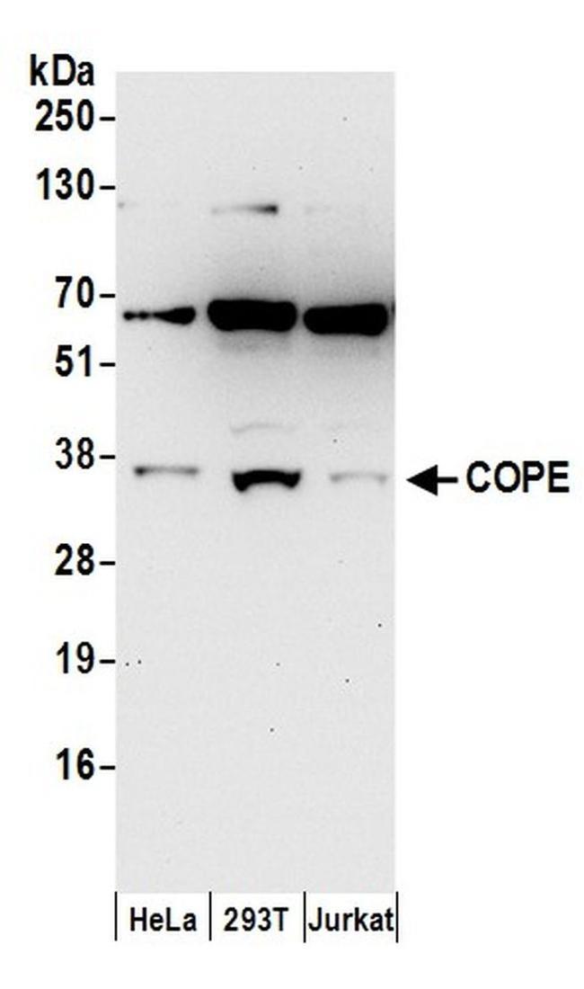 COPE Antibody in Western Blot (WB)