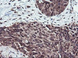 COPS5 Antibody in Immunohistochemistry (Paraffin) (IHC (P))