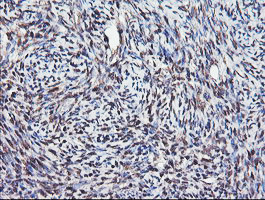 COPS5 Antibody in Immunohistochemistry (Paraffin) (IHC (P))