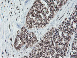 COPS5 Antibody in Immunohistochemistry (Paraffin) (IHC (P))