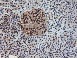 COPS5 Antibody in Immunohistochemistry (Paraffin) (IHC (P))