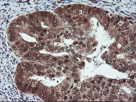 COPS5 Antibody in Immunohistochemistry (Paraffin) (IHC (P))