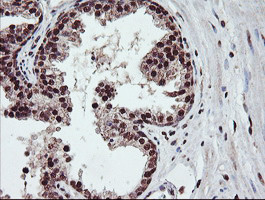 COPS5 Antibody in Immunohistochemistry (Paraffin) (IHC (P))