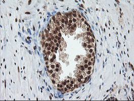 COPS5 Antibody in Immunohistochemistry (Paraffin) (IHC (P))