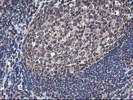 COPS5 Antibody in Immunohistochemistry (Paraffin) (IHC (P))