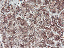 COPS5 Antibody in Immunohistochemistry (Paraffin) (IHC (P))