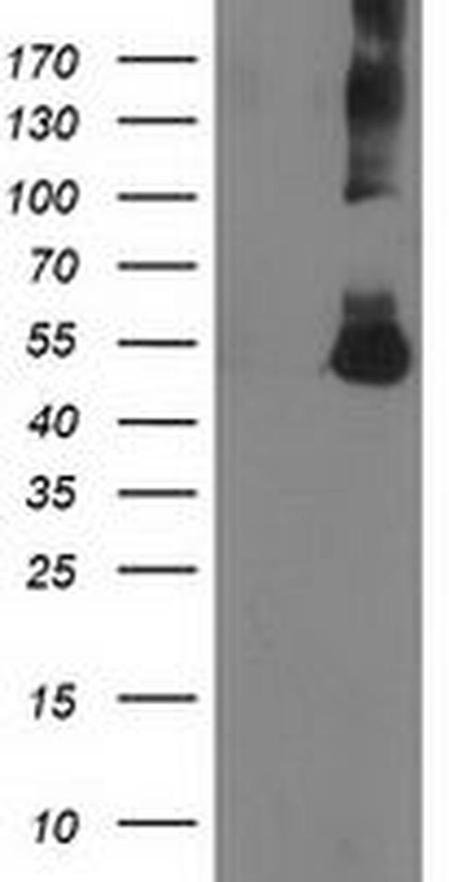 CORO1A Antibody in Western Blot (WB)