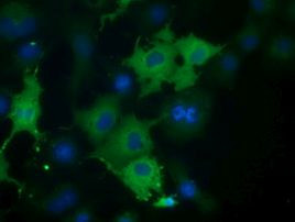 CORO1B Antibody in Immunocytochemistry (ICC/IF)