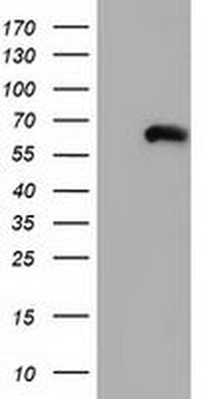 CORO1B Antibody in Western Blot (WB)