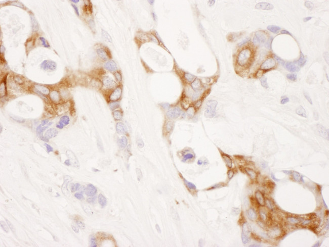 COX-2 Antibody in Immunohistochemistry (IHC)