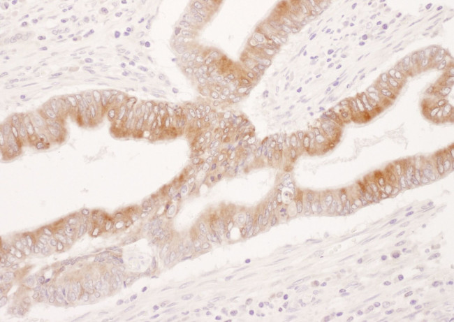 COX-2 Antibody in Immunohistochemistry (IHC)