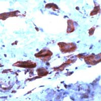 COX2 Antibody in Immunohistochemistry (Paraffin) (IHC (P))