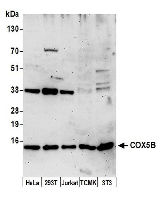 COX5B Antibody in Western Blot (WB)