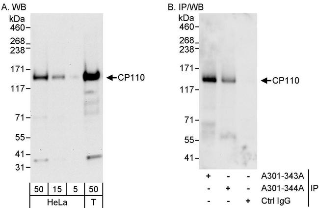 CP110 Antibody in Western Blot (WB)