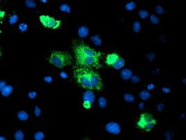 CPA2 Antibody in Immunocytochemistry (ICC/IF)