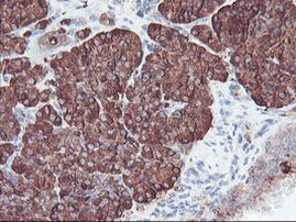 CPA2 Antibody in Immunohistochemistry (Paraffin) (IHC (P))