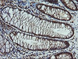 CPA2 Antibody in Immunohistochemistry (Paraffin) (IHC (P))