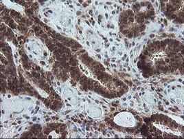 CPA2 Antibody in Immunohistochemistry (Paraffin) (IHC (P))