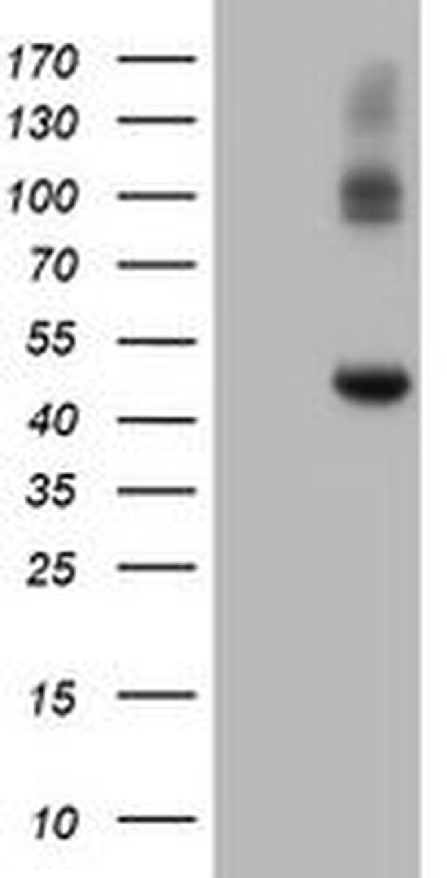 CPA2 Antibody in Western Blot (WB)