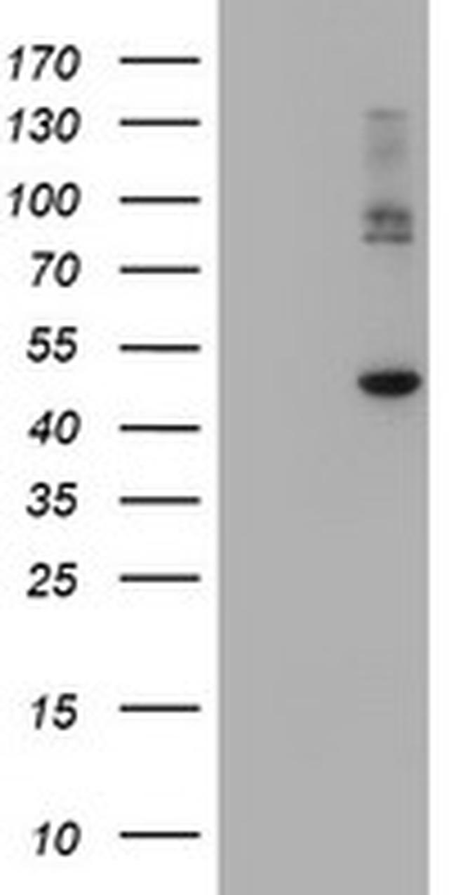 CPA2 Antibody in Western Blot (WB)